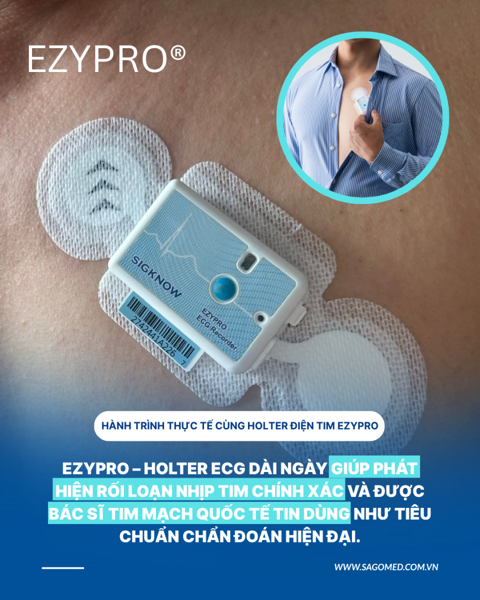 [Series] Hành Trình Thực Tế Cùng Holter Điện Tim EZYPRO