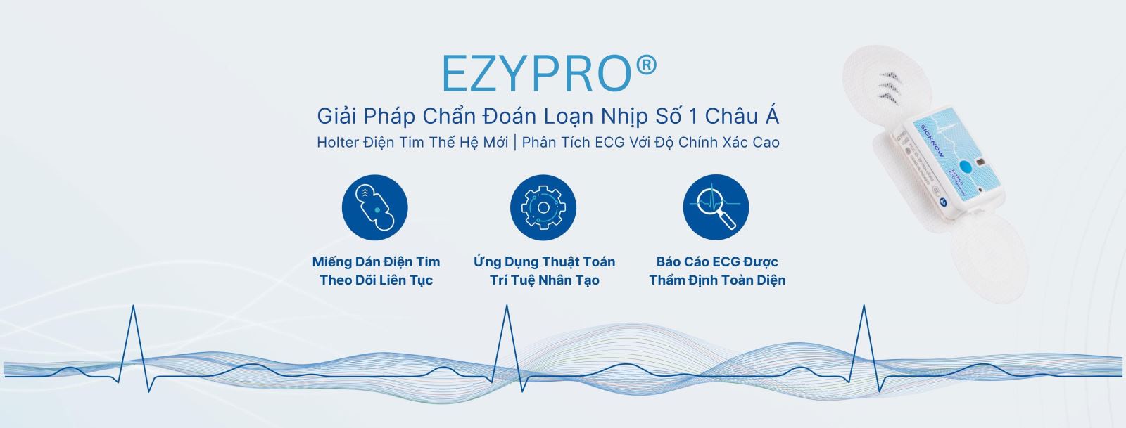 Holter 24h bỏ sót rối loạn nhịp: Vì sao cần theo dõi tim dài ngày?
